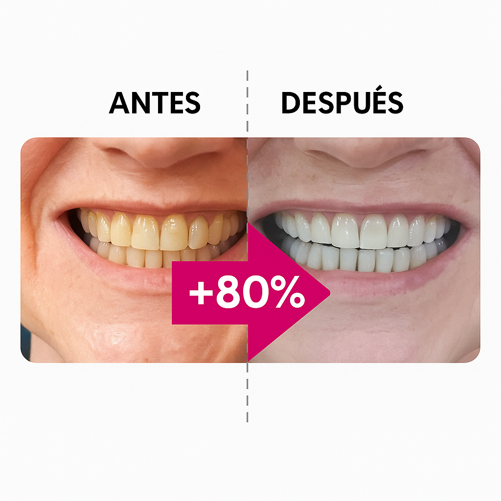 Mirova™ Lápiz Blanqueador - Dientes visiblemente más blancos en solo 3 días